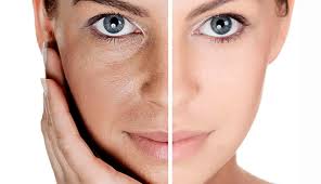 Maquiagem para pele com melasma: Erros comuns a evitar